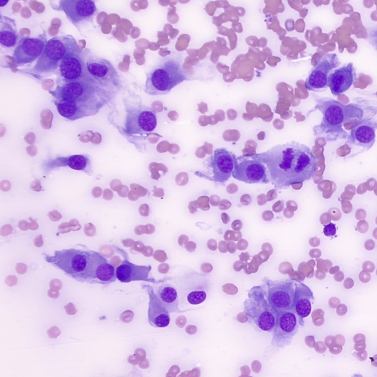 Photomicrograph showing cytology sample under microscope