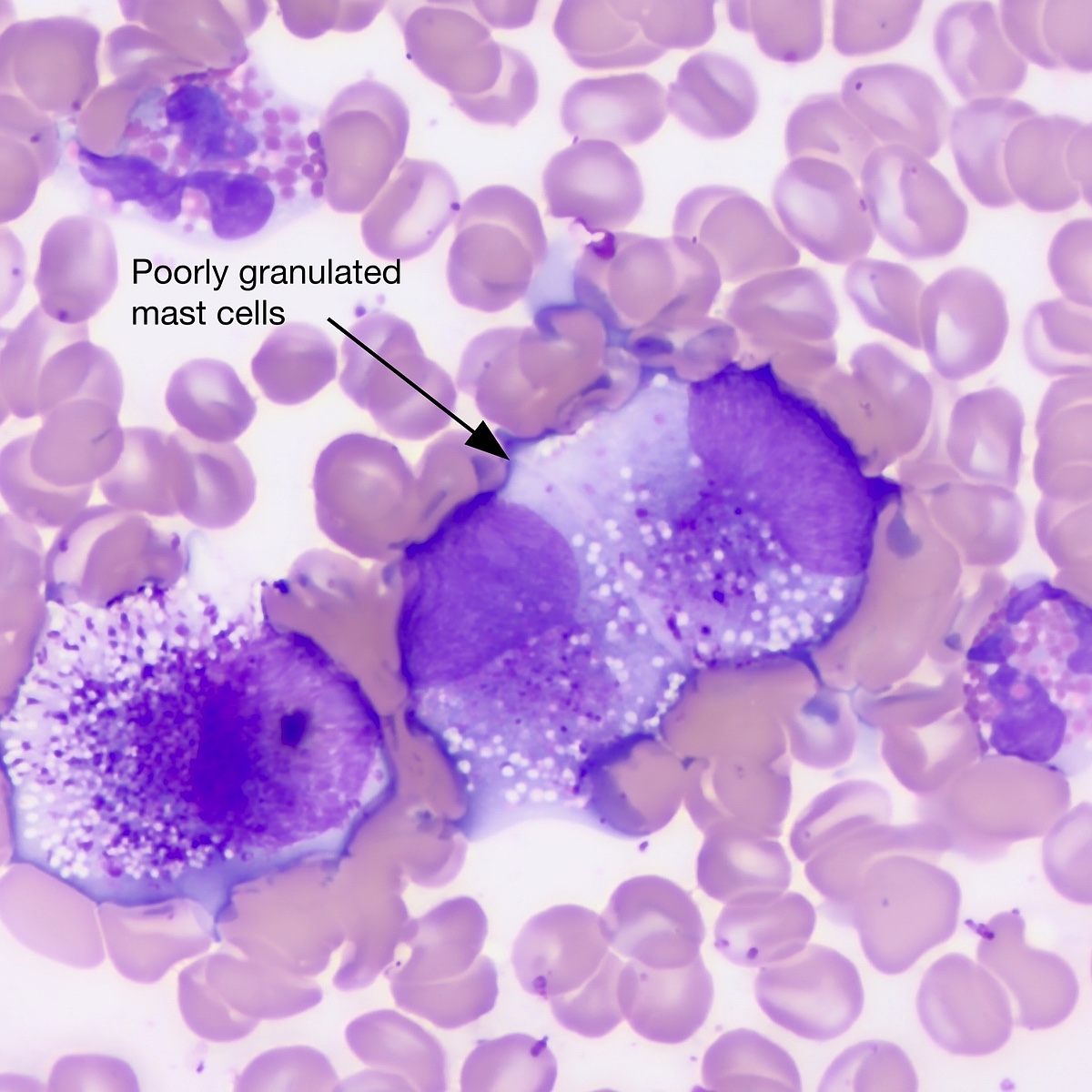 Photomicrograph of a poorly granulated mast cell tumor demonstrating fine cytologic detail
